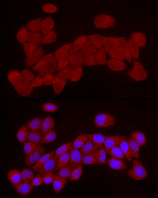 RARRES2 Rabbit polyclonal antibody