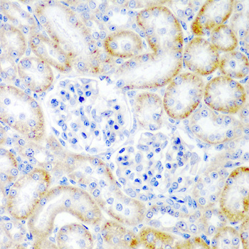 RLN2 Rabbit polyclonal antibody