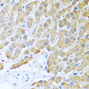 CCL8 Rabbit polyclonal antibody