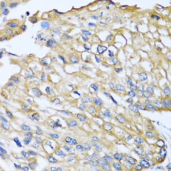 CCL8 Rabbit polyclonal antibody