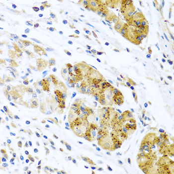 CCL8 Rabbit polyclonal antibody