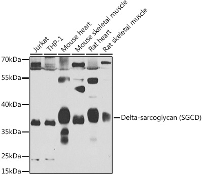 Delta-sarcoglycan (SGCD) Rabbit polyclonal antibody
