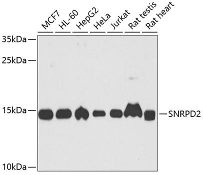 SNRPD2 Rabbit polyclonal antibody