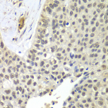 SNRPD2 Rabbit polyclonal antibody
