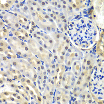 SNRPD2 Rabbit polyclonal antibody