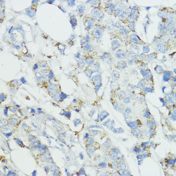 SOD3 Rabbit polyclonal antibody