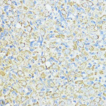 SOD3 Rabbit polyclonal antibody