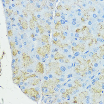 SOD3 Rabbit polyclonal antibody