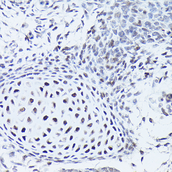 SOX5 Rabbit polyclonal antibody