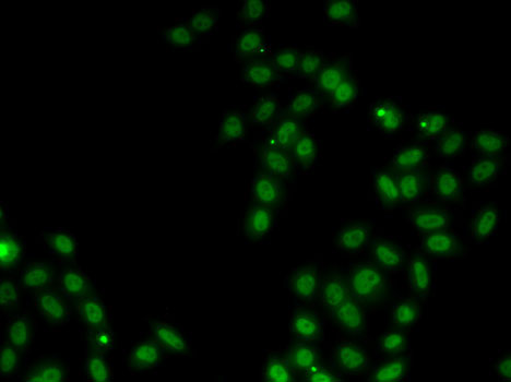 SOX5 Rabbit polyclonal antibody