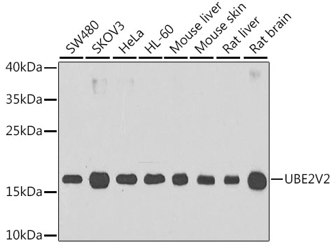 UBE2V2 Rabbit polyclonal antibody