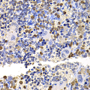 UBE2V2 Rabbit polyclonal antibody