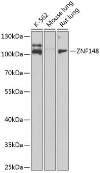 ZNF148 Rabbit polyclonal antibody