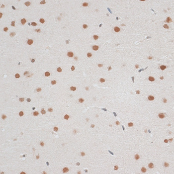 ZNF148 Rabbit polyclonal antibody
