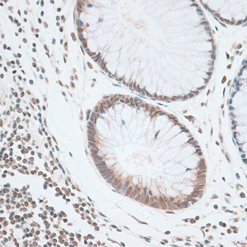 ZNF148 Rabbit polyclonal antibody