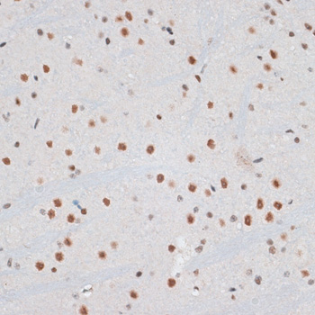 ZNF148 Rabbit polyclonal antibody