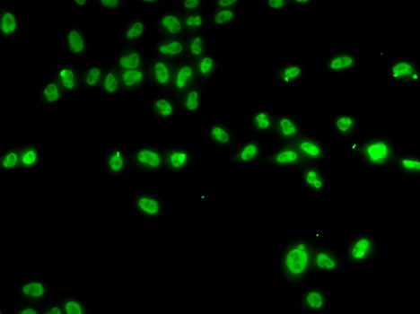 ZNF148 Rabbit polyclonal antibody