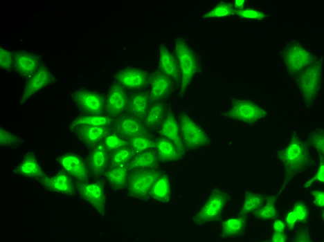ZNF217 Rabbit polyclonal antibody