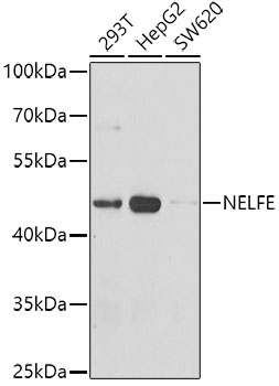 NELFE Rabbit polyclonal antibody
