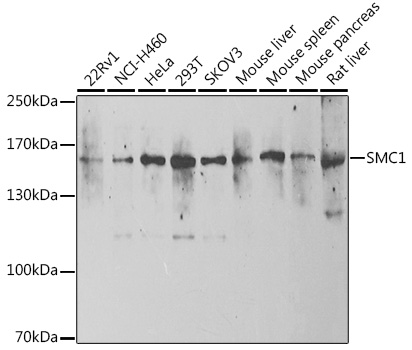 SMC1 Rabbit pAb