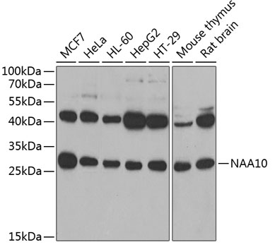 NAA10 Rabbit polyclonal antibody