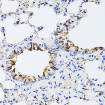 NAA10 Rabbit polyclonal antibody