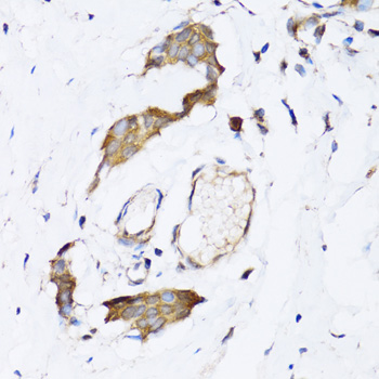 NAA10 Rabbit polyclonal antibody