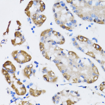NAA10 Rabbit polyclonal antibody