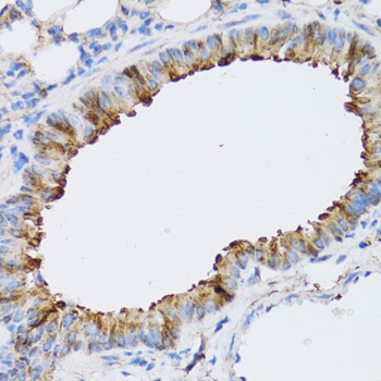 NAA10 Rabbit polyclonal antibody