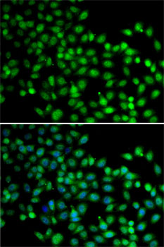 FKBP6 Rabbit polyclonal antibody