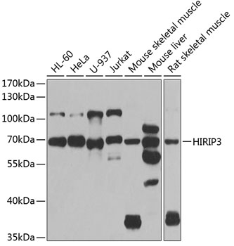 HIRIP3 Rabbit polyclonal antibody