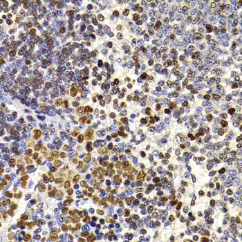HIRIP3 Rabbit polyclonal antibody