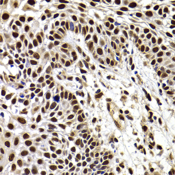 HIRIP3 Rabbit polyclonal antibody
