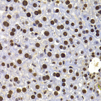 HIRIP3 Rabbit polyclonal antibody