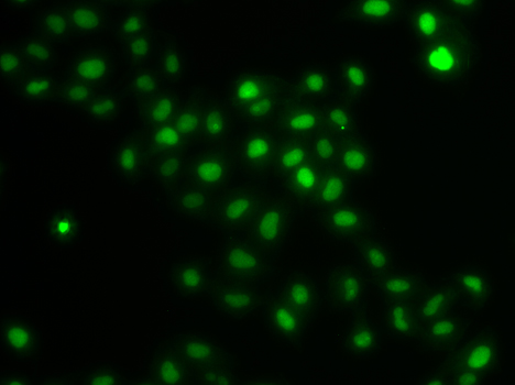 HIRIP3 Rabbit polyclonal antibody