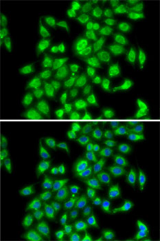 COPS3 Rabbit polyclonal antibody