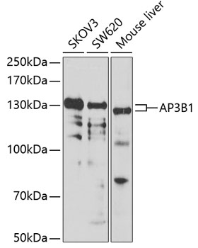 AP3B1 Rabbit polyclonal antibody