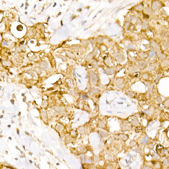 AP3B1 Rabbit polyclonal antibody