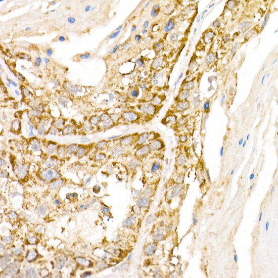 AP3B1 Rabbit polyclonal antibody