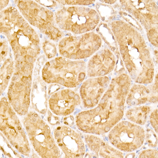 AP3B1 Rabbit polyclonal antibody