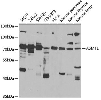 ASMTL Rabbit polyclonal antibody