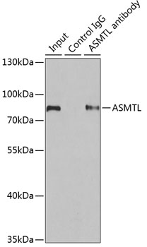 ASMTL Rabbit polyclonal antibody