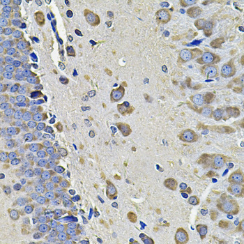 EIF3C Rabbit polyclonal antibody