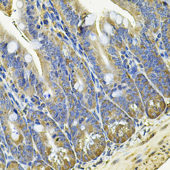EIF3C Rabbit polyclonal antibody