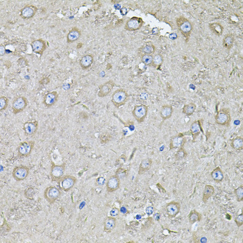 EIF3C Rabbit polyclonal antibody