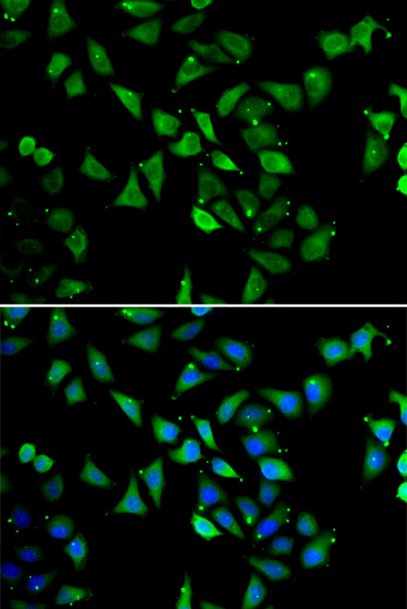 EIF3C Rabbit polyclonal antibody