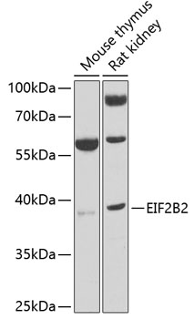 EIF2B2 Rabbit polyclonal antibody