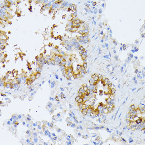EIF2B2 Rabbit polyclonal antibody