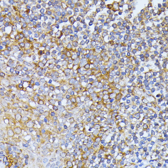 EIF2B2 Rabbit polyclonal antibody