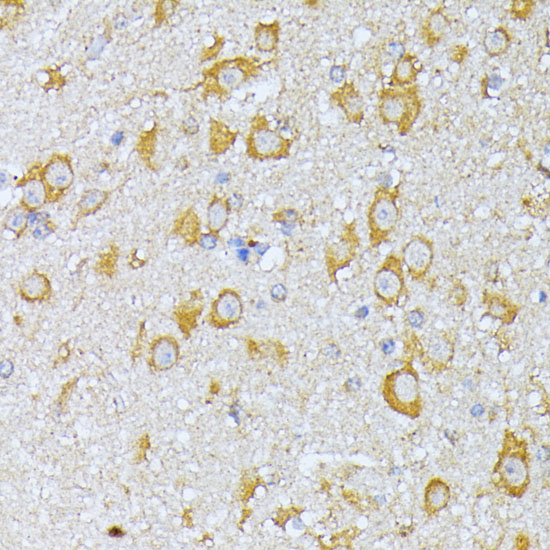 EIF2B2 Rabbit polyclonal antibody